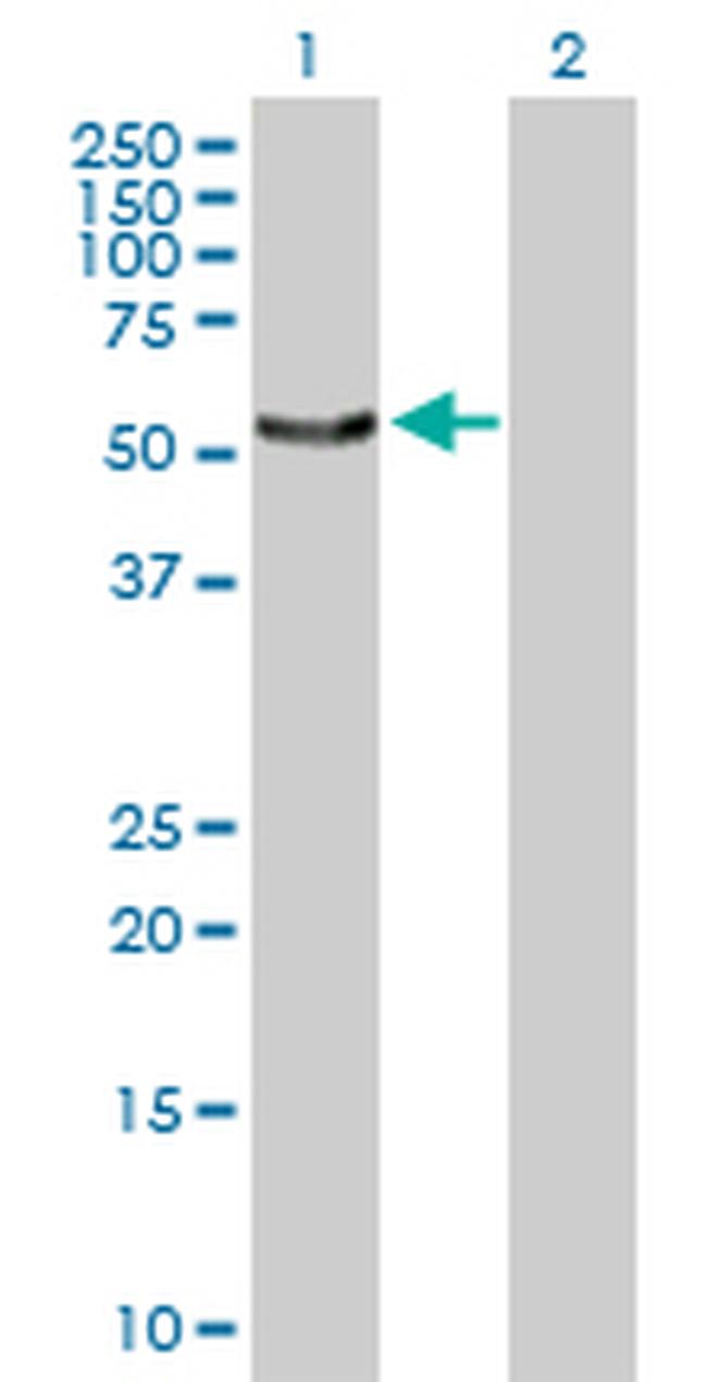 SNX4 Antibody in Western Blot (WB)