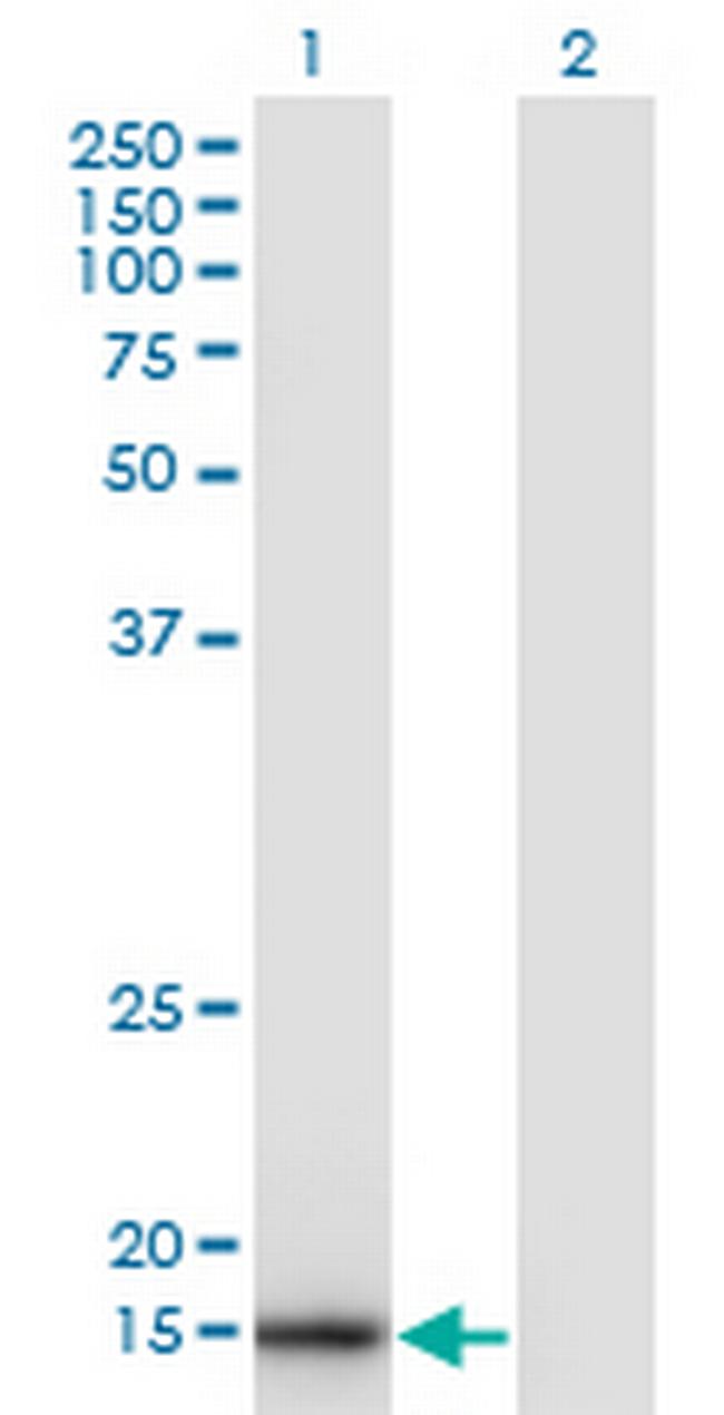 SNX3 Antibody in Western Blot (WB)