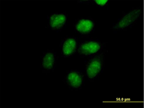 EED Antibody in Immunocytochemistry (ICC/IF)