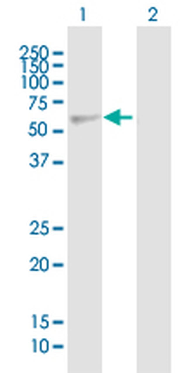 EED Antibody in Western Blot (WB)