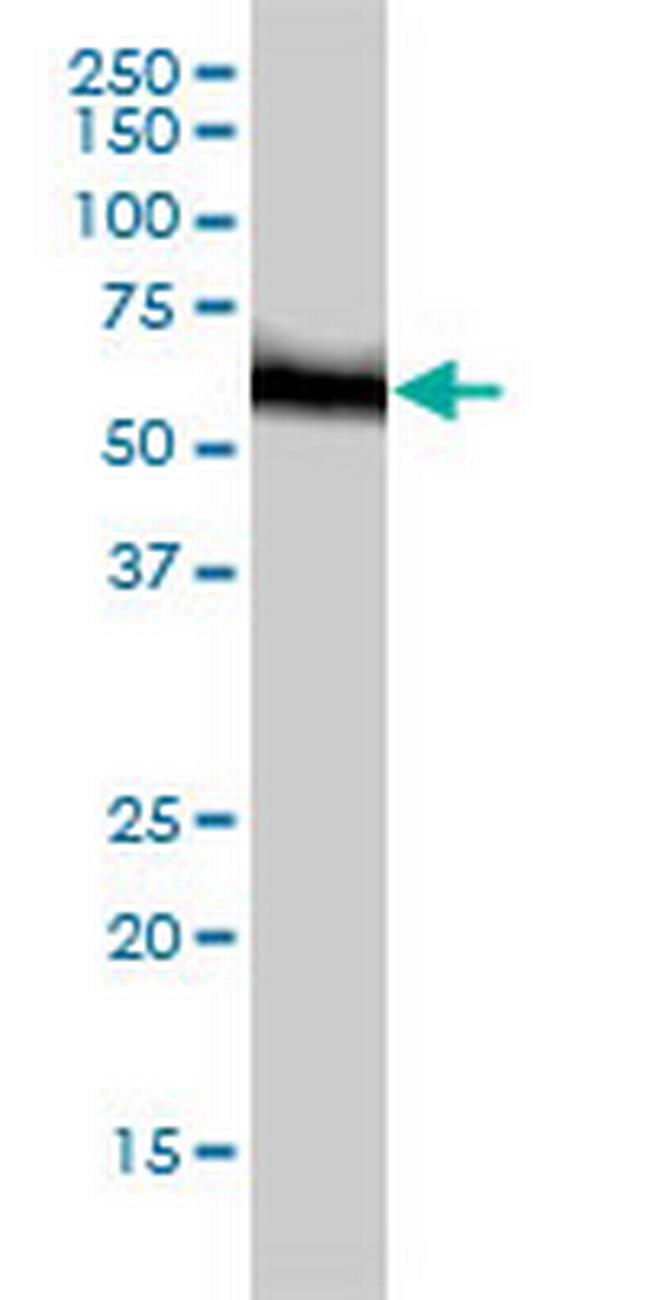 RNMT Antibody in Western Blot (WB)