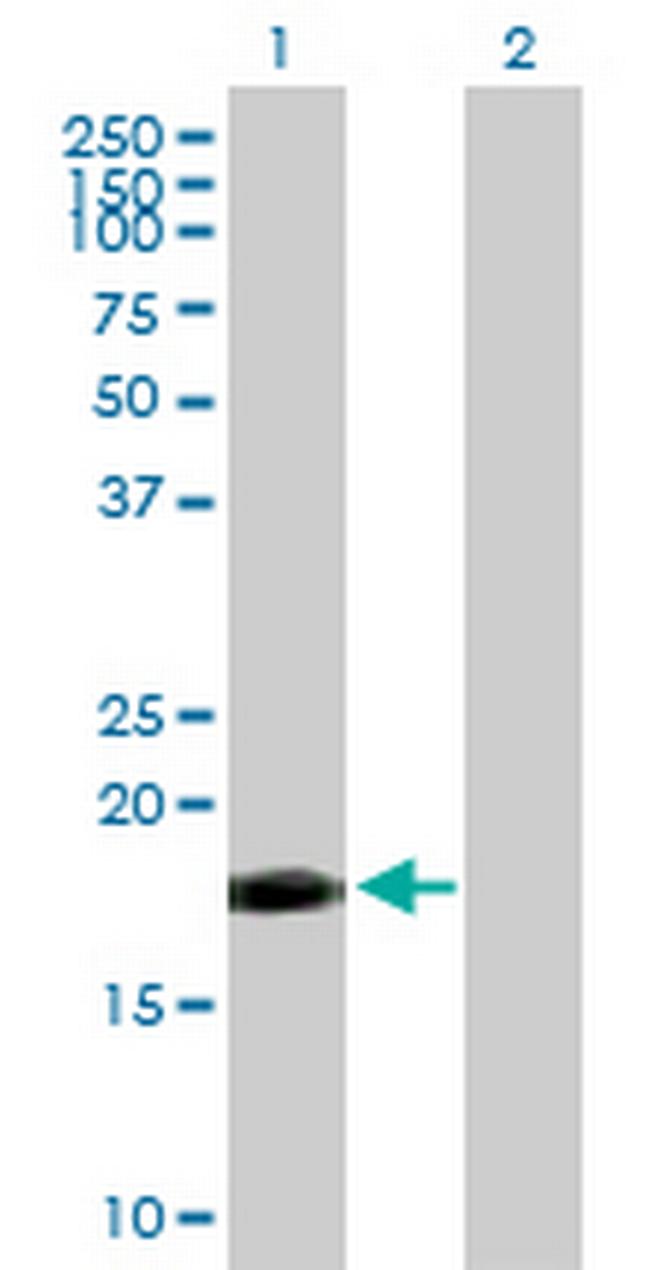 TNFSF12 Antibody in Western Blot (WB)