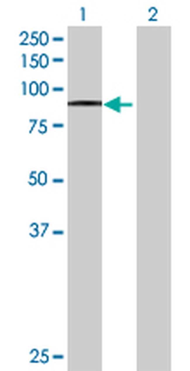 ADAM15 Antibody in Western Blot (WB)