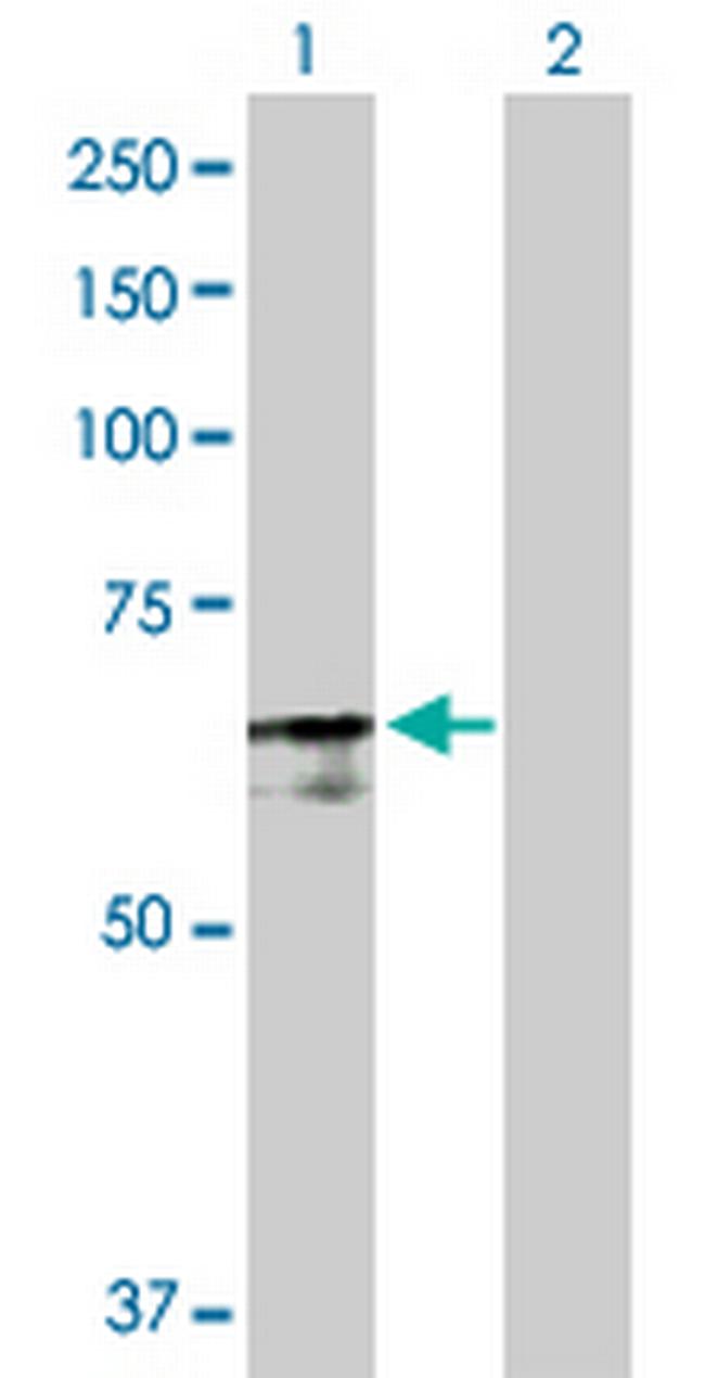 PABPC4 Antibody in Western Blot (WB)