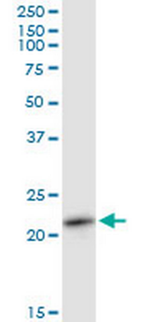 RAB11A Antibody in Western Blot (WB)