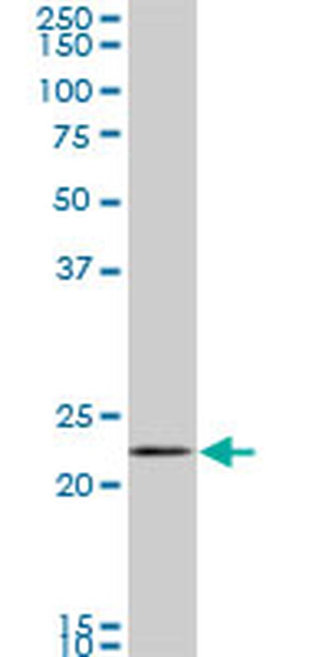 RAB11A Antibody in Western Blot (WB)