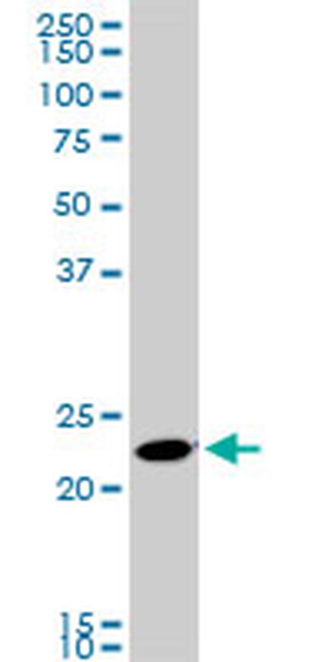 RAB11A Antibody in Western Blot (WB)