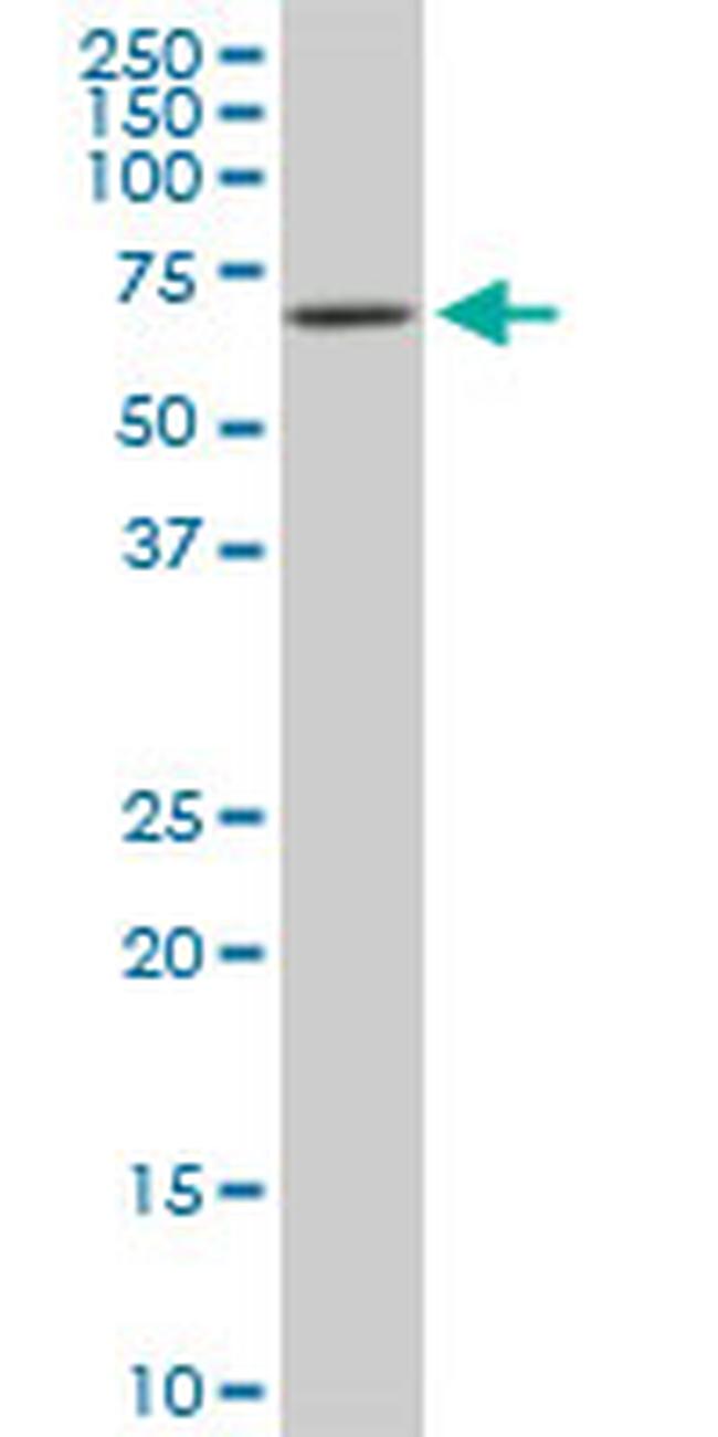 RIPK2 Antibody in Western Blot (WB)