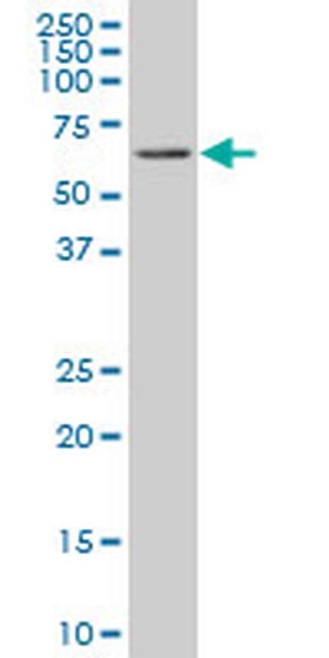 RIPK2 Antibody in Western Blot (WB)