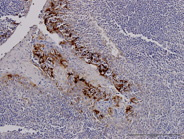 TNFRSF6B Antibody in Immunohistochemistry (Paraffin) (IHC (P))