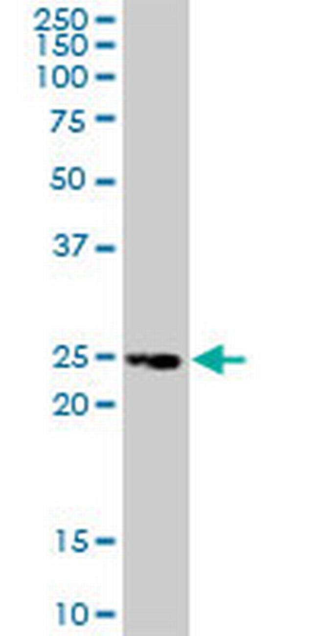 TNFRSF18 Antibody in Western Blot (WB)