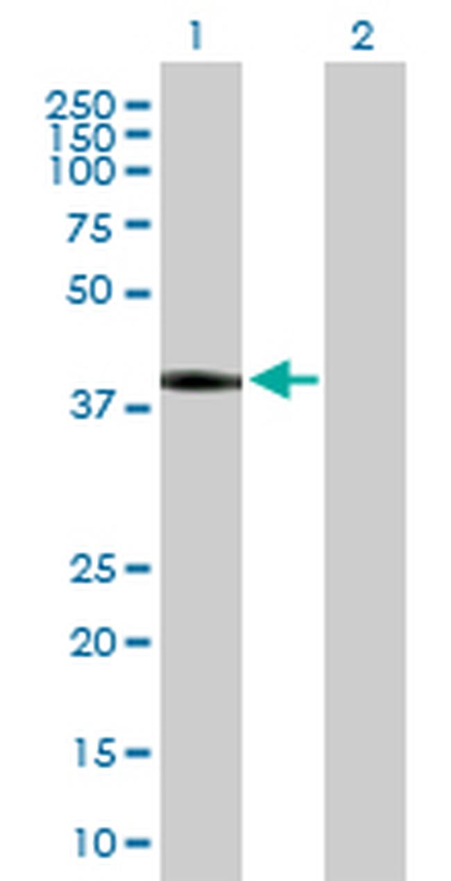 DLK1 Antibody in Western Blot (WB)