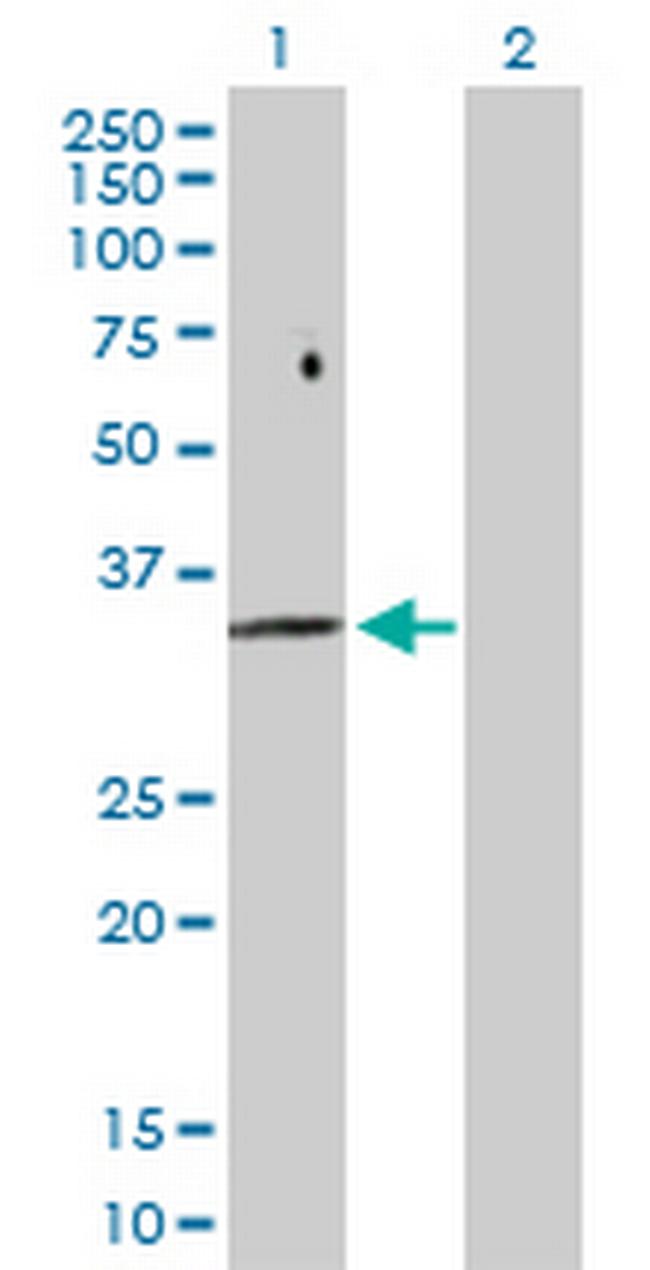 FBP2 Antibody in Western Blot (WB)