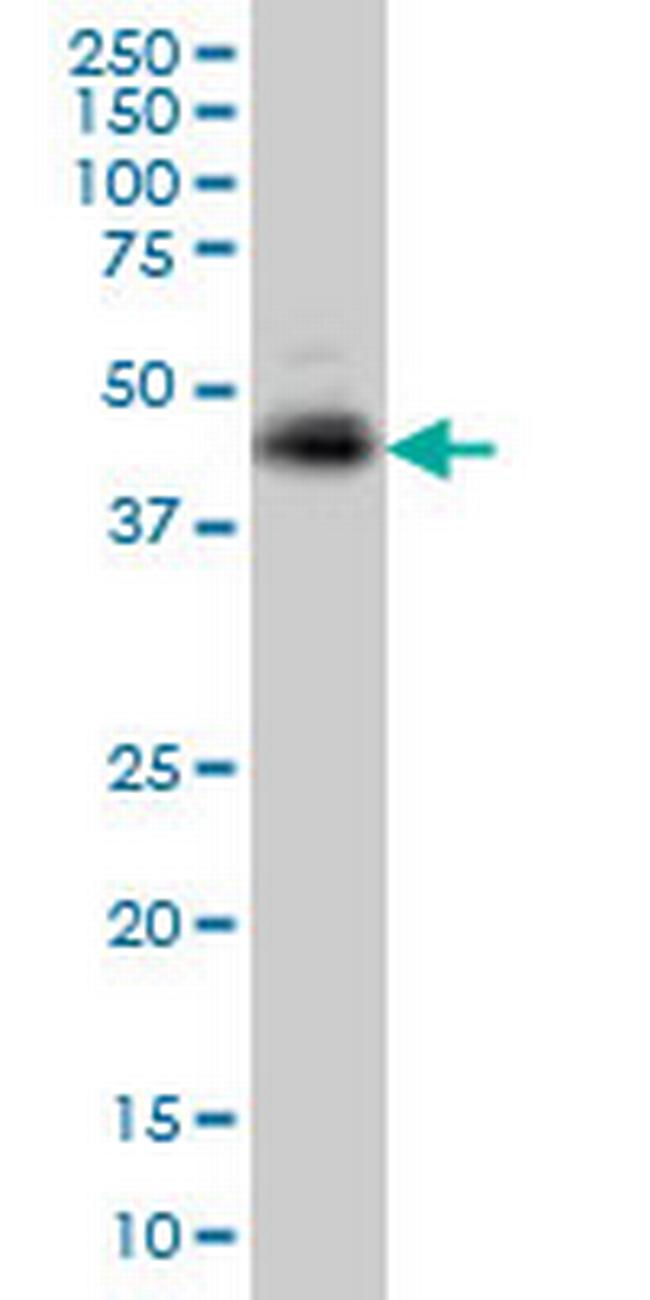 TNFRSF10A Antibody in Western Blot (WB)