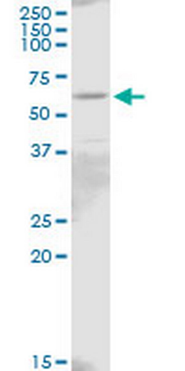 IL18R1 Antibody in Western Blot (WB)