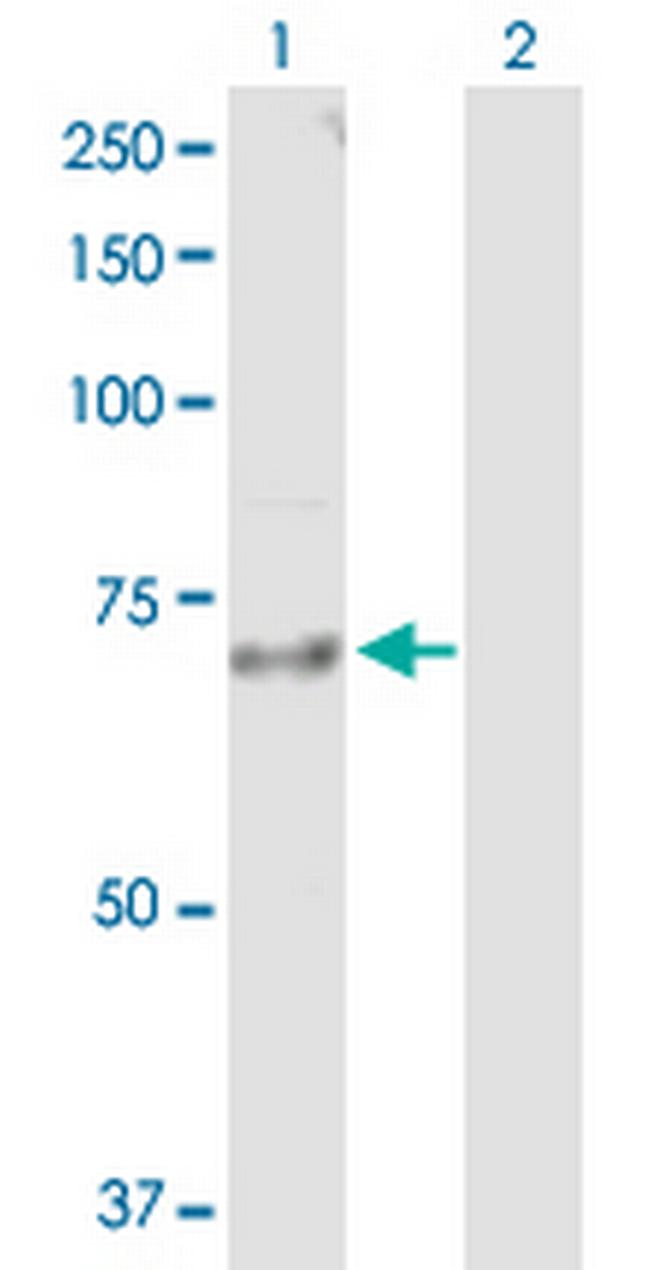 IL18R1 Antibody in Western Blot (WB)