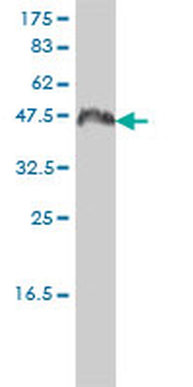 CCNK Antibody in Western Blot (WB)