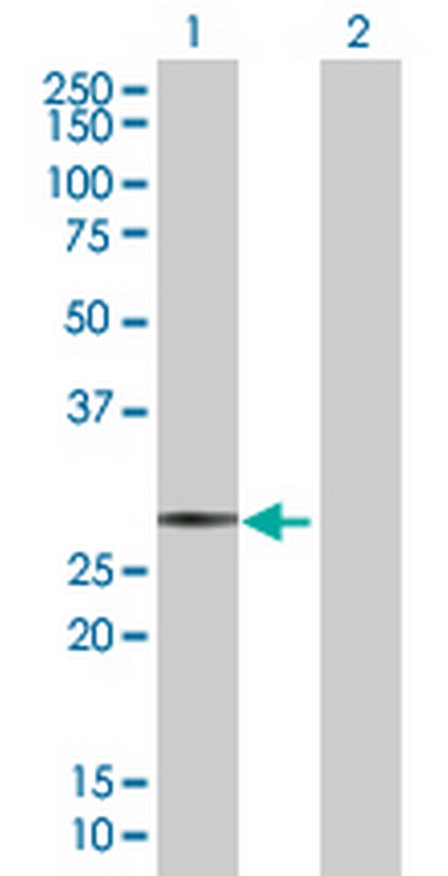 SAP30 Antibody in Western Blot (WB)