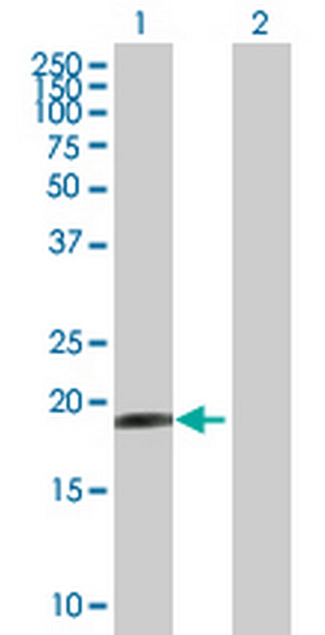 HESX1 Antibody in Western Blot (WB)