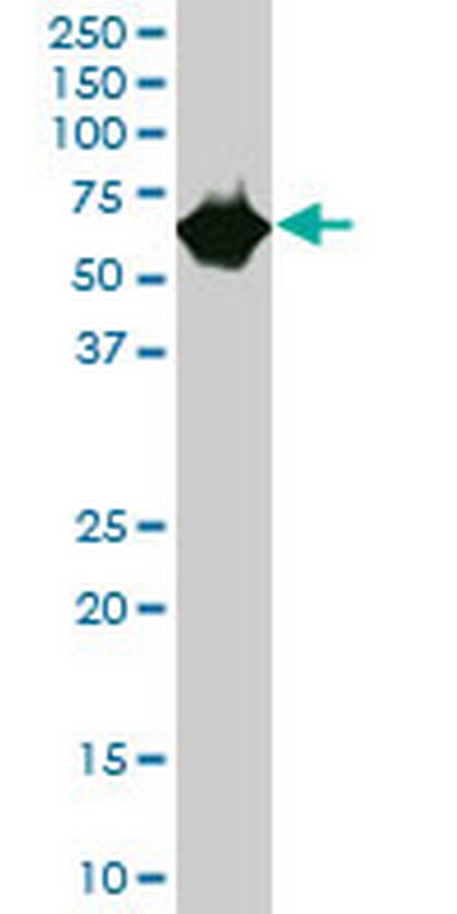 CES2 Antibody in Western Blot (WB)