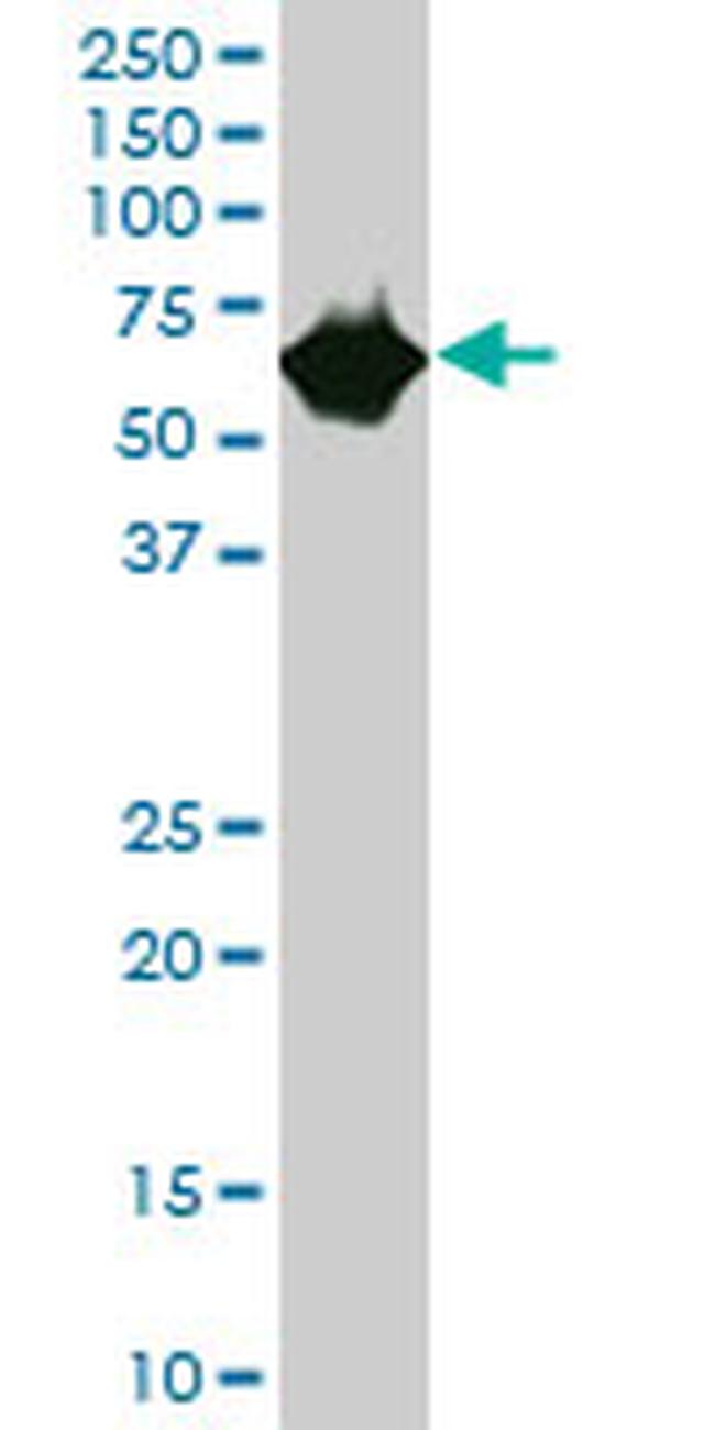 CES2 Antibody in Western Blot (WB)