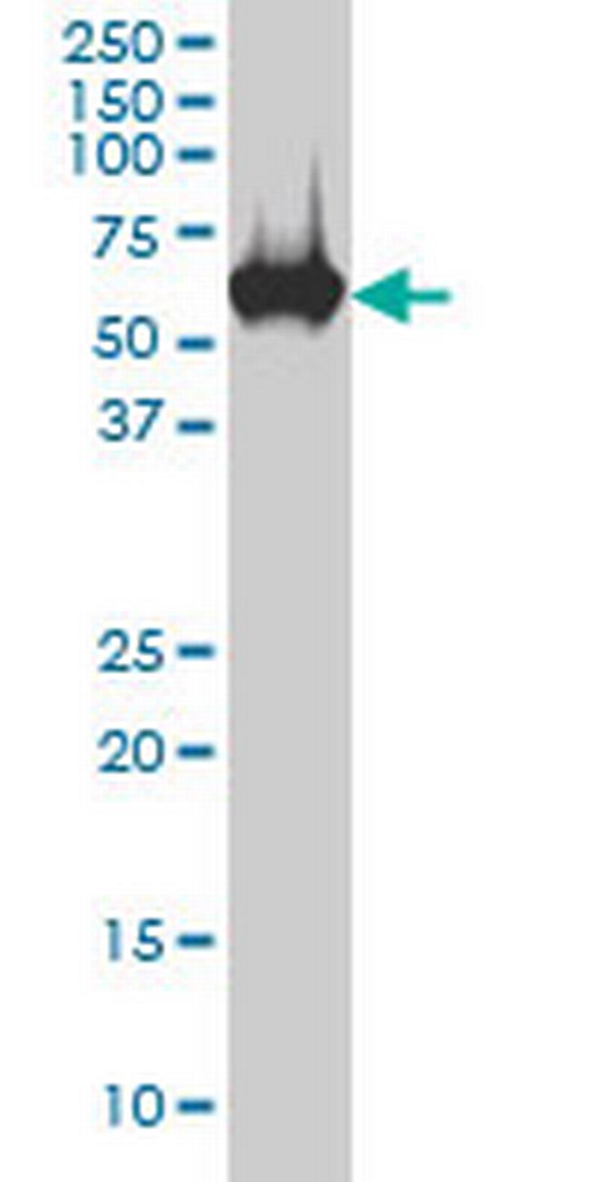 CES2 Antibody in Western Blot (WB)