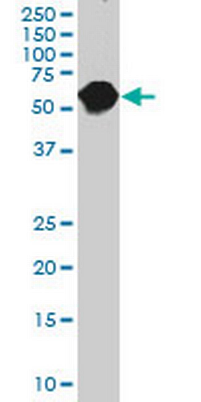 CES2 Antibody in Western Blot (WB)