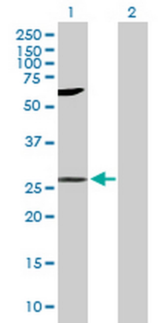 LIN7A Antibody in Western Blot (WB)