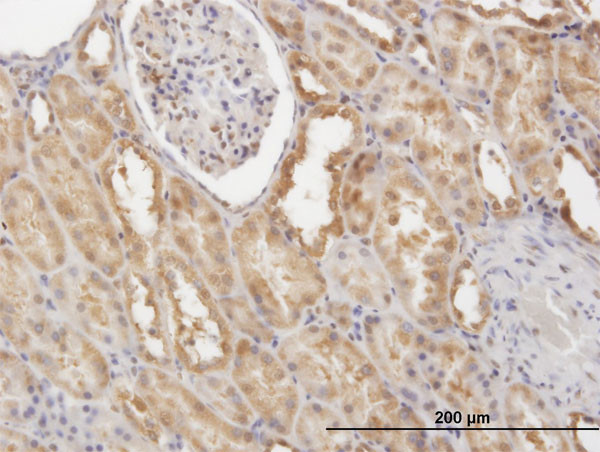 CFLAR Antibody in Immunohistochemistry (Paraffin) (IHC (P))