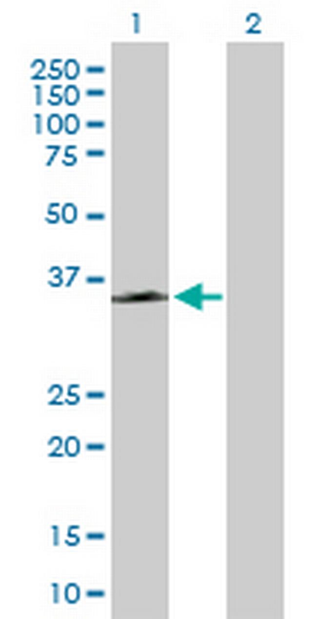 GPR109B Antibody in Western Blot (WB)