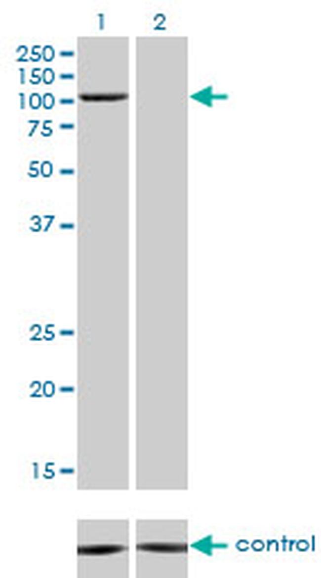 PCAF Antibody in Western Blot (WB)