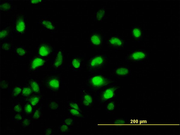 PCAF Antibody in Immunocytochemistry (ICC/IF)