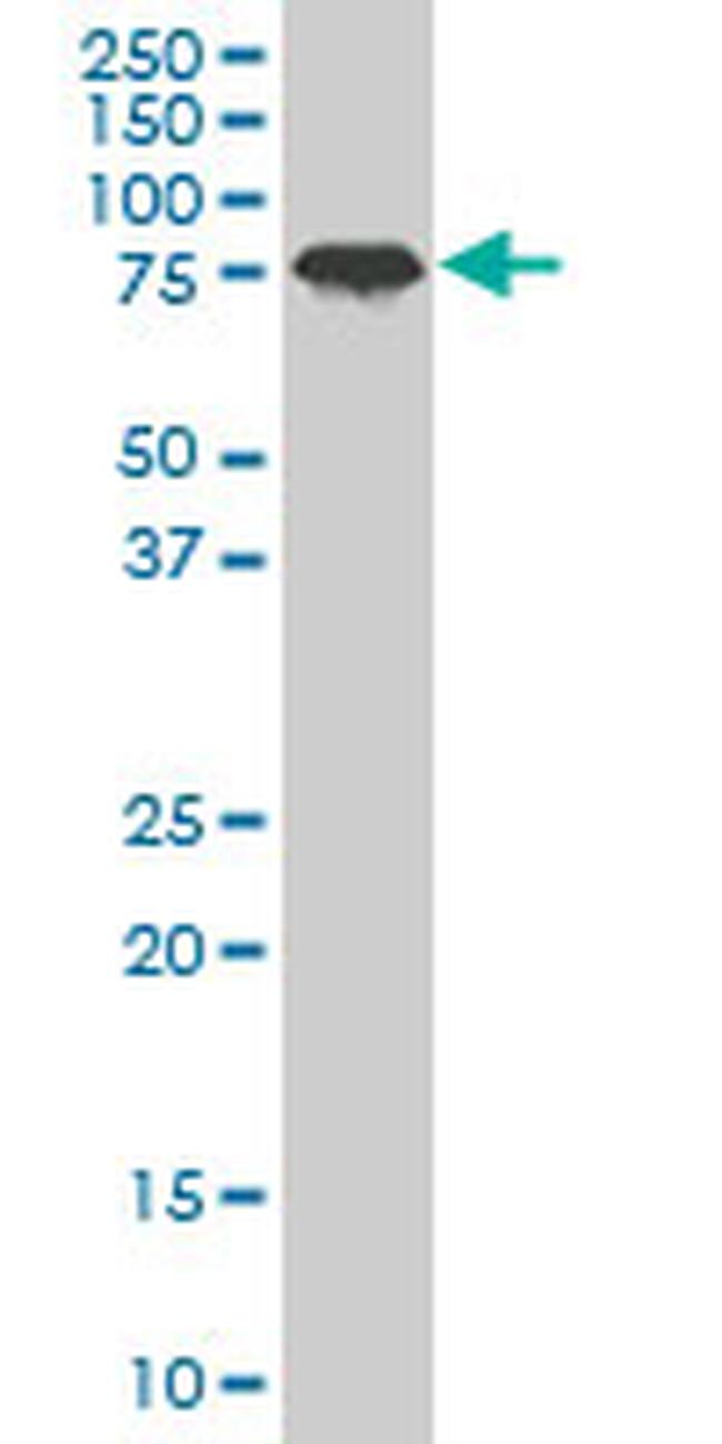 PCAF Antibody in Western Blot (WB)