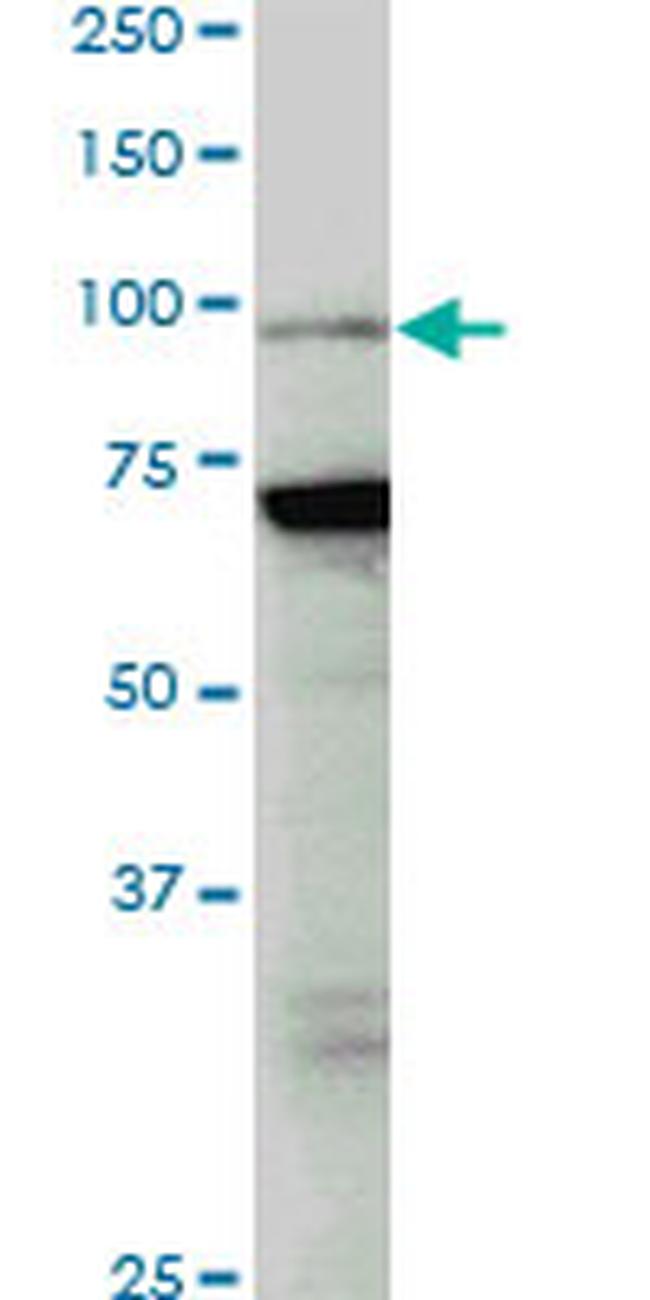 PCAF Antibody in Western Blot (WB)