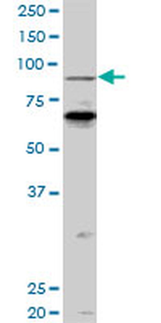 PCAF Antibody in Western Blot (WB)