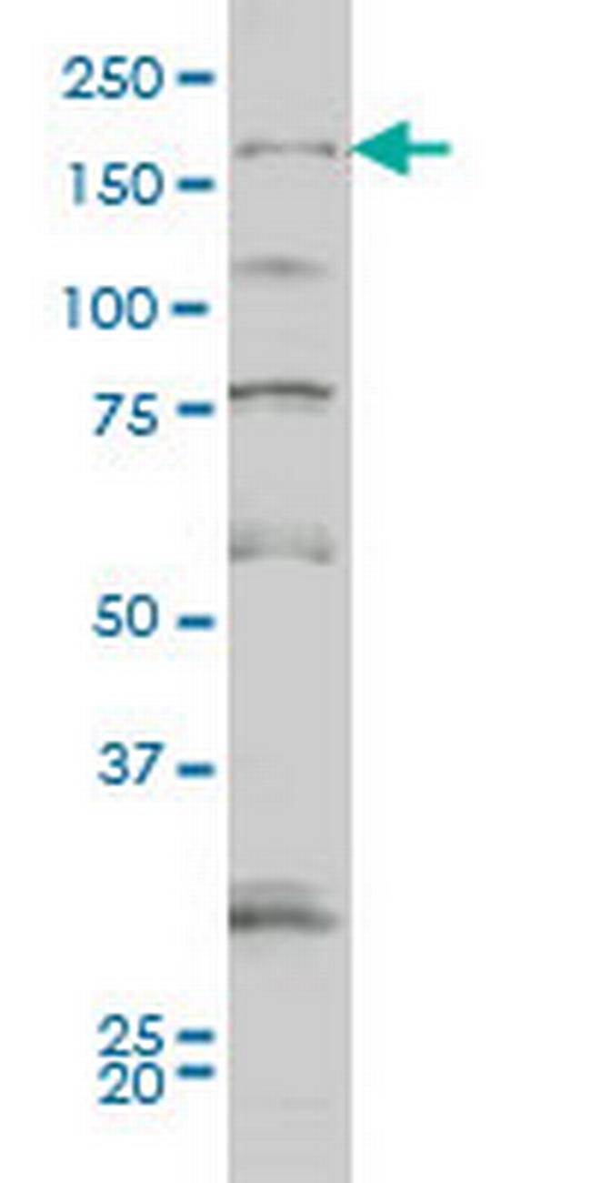 SYNJ1 Antibody in Western Blot (WB)