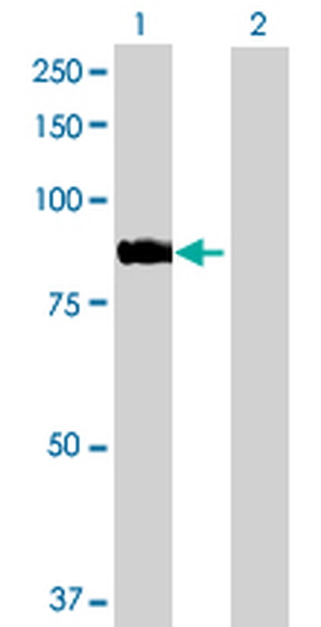 ARHGEF7 Antibody in Western Blot (WB)