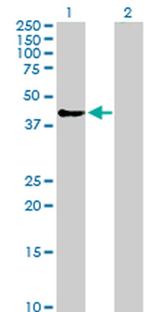 SPHK1 Antibody in Western Blot (WB)