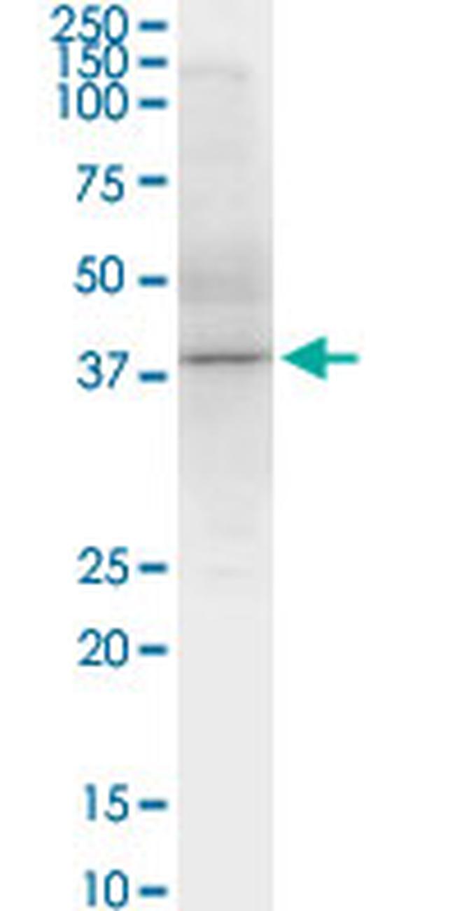 SPHK1 Antibody in Western Blot (WB)