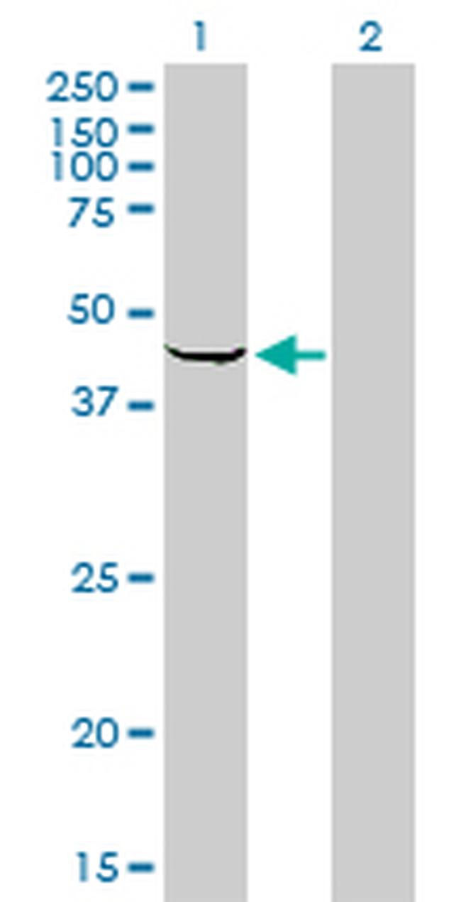 SPHK1 Antibody in Western Blot (WB)