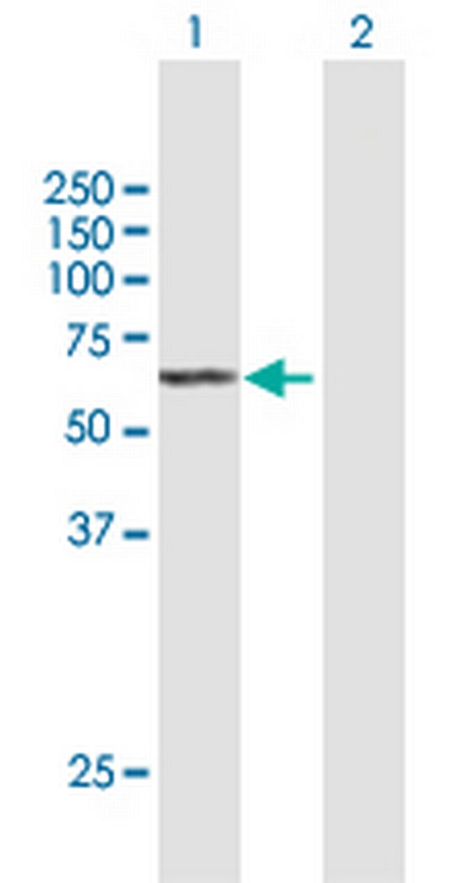 SGPL1 Antibody in Western Blot (WB)