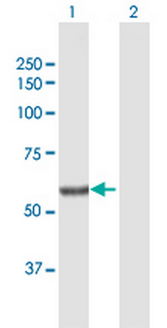 SGPL1 Antibody in Western Blot (WB)