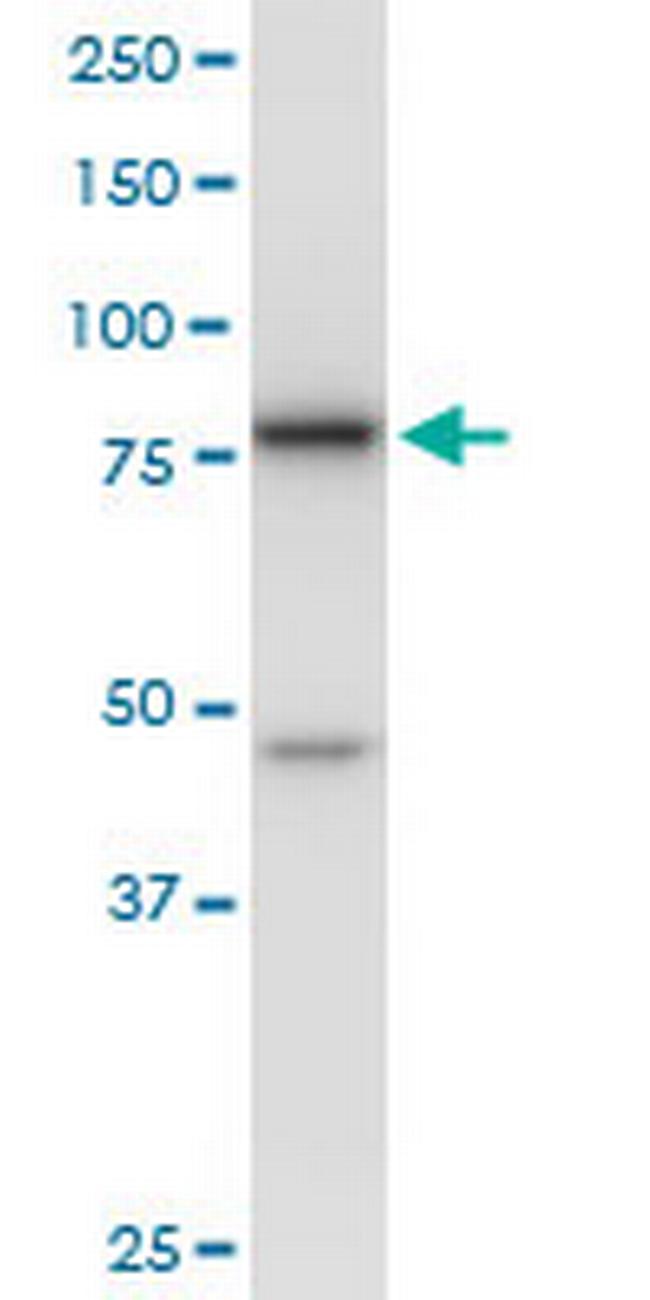DDX18 Antibody in Western Blot (WB)