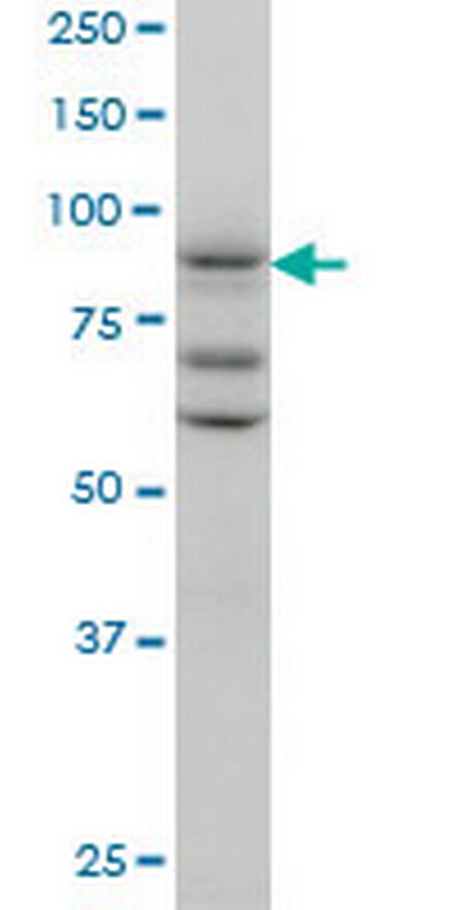 TAX1BP1 Antibody in Western Blot (WB)