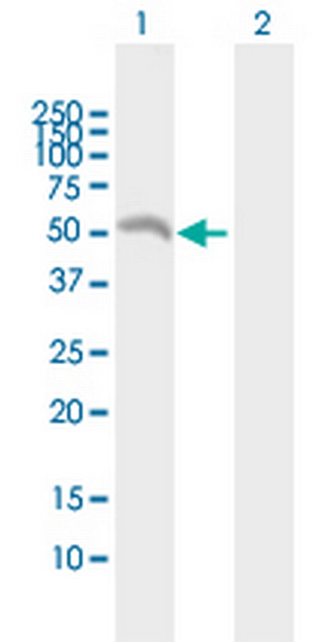 EIF2B3 Antibody in Western Blot (WB)