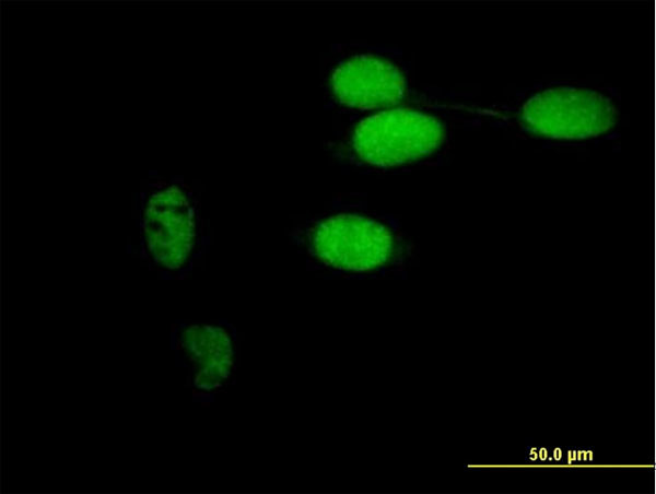 TIMELESS Antibody in Immunocytochemistry (ICC/IF)