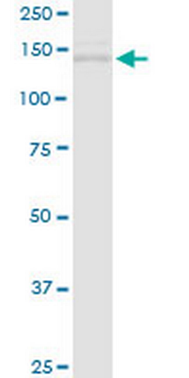 TIMELESS Antibody in Western Blot (WB)