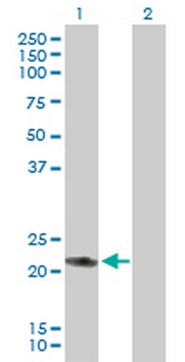 RAB7L1 Antibody in Western Blot (WB)