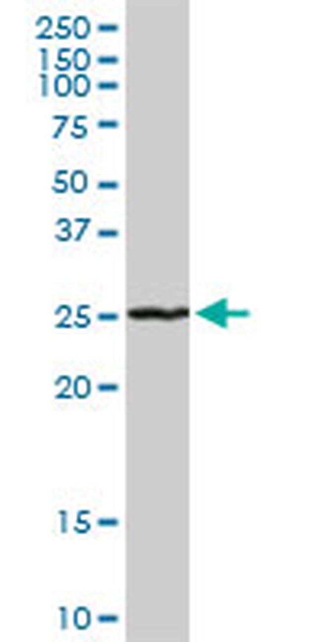 RAB7L1 Antibody in Western Blot (WB)