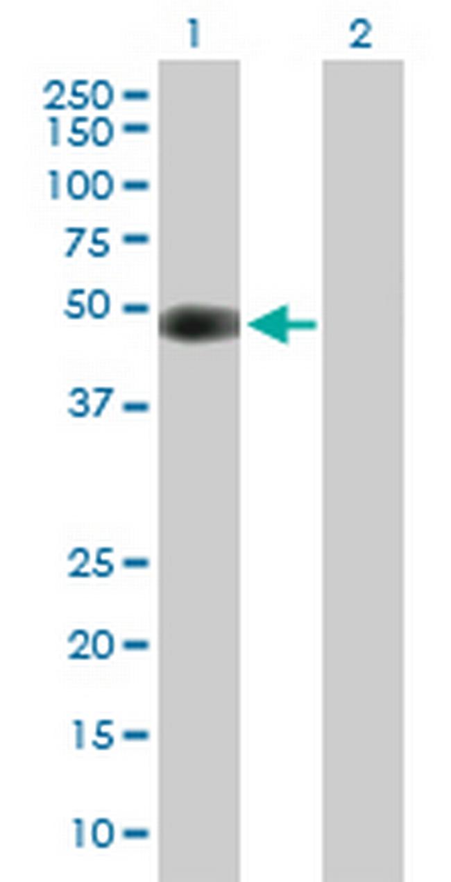 CDK5R2 Antibody in Western Blot (WB)